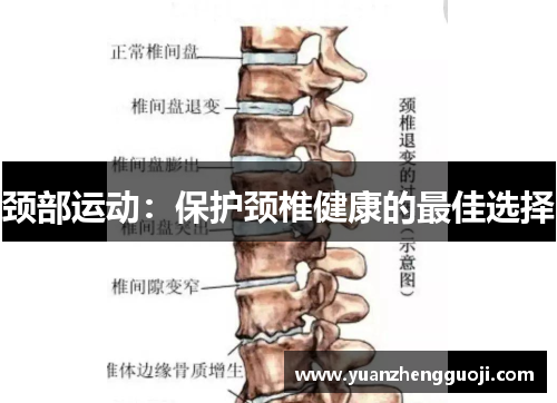 颈部运动：保护颈椎健康的最佳选择